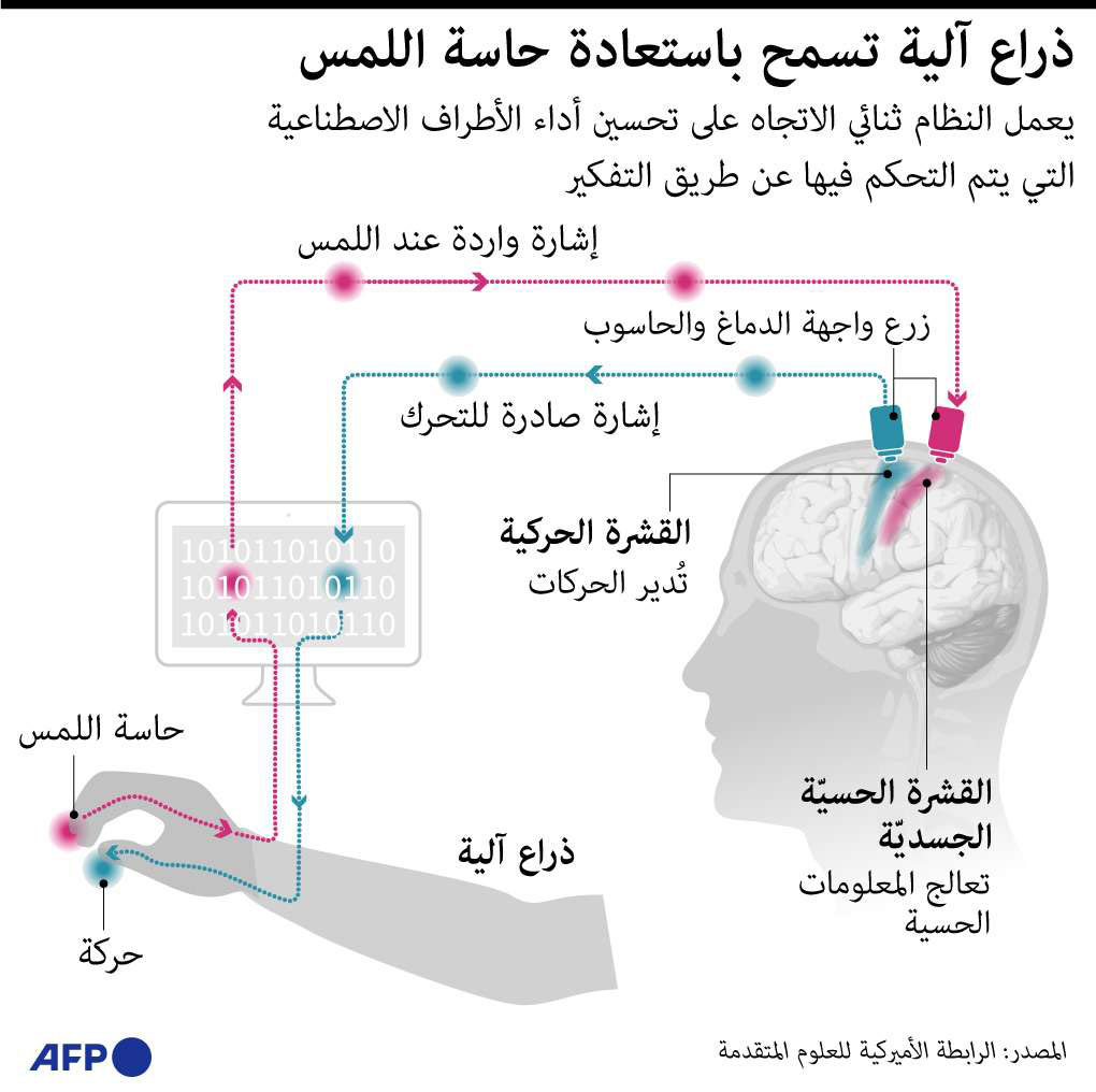ذراع آلية