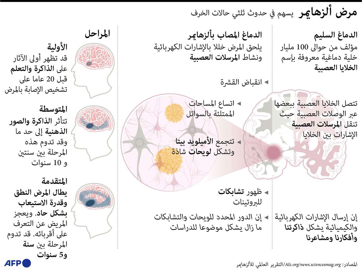 غراف مرض الزهايمر