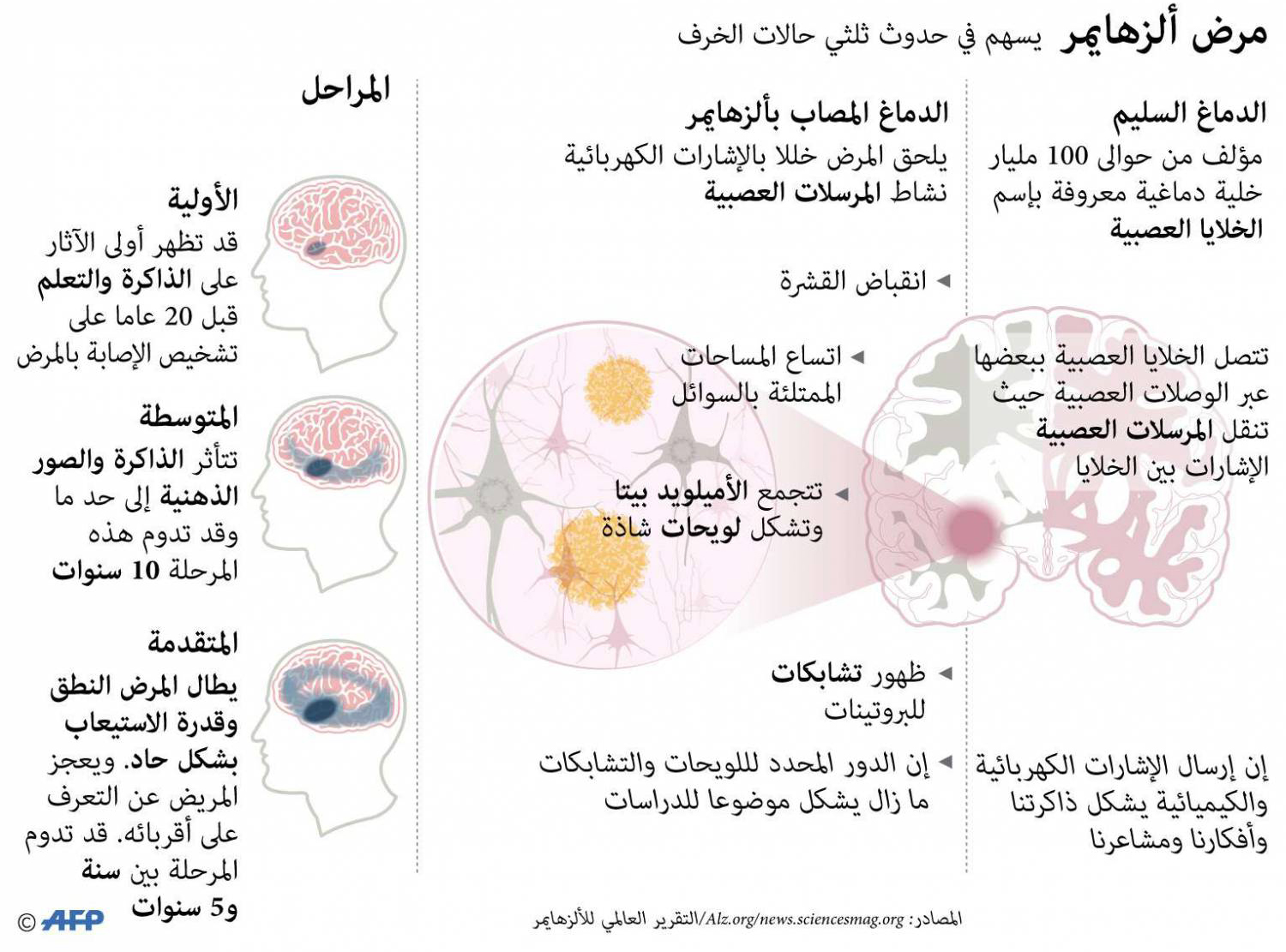 غراف