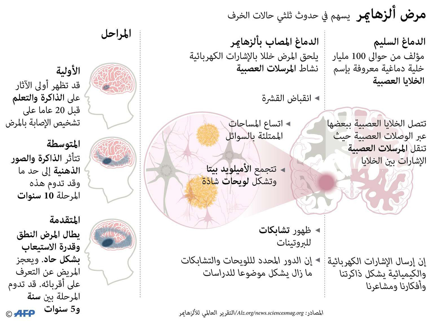 لا توجد أي أدوية تعالج بفعالية مرض الزهايمر