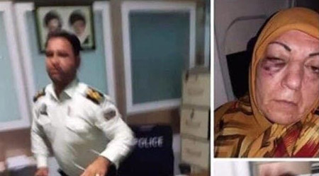 الفيديو وثق أثار كدمات واضحة قرب عين السيدة، التي أكدت أنها لم تعرف سبب تعرضها للضرب