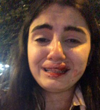 اعتداء وحشي