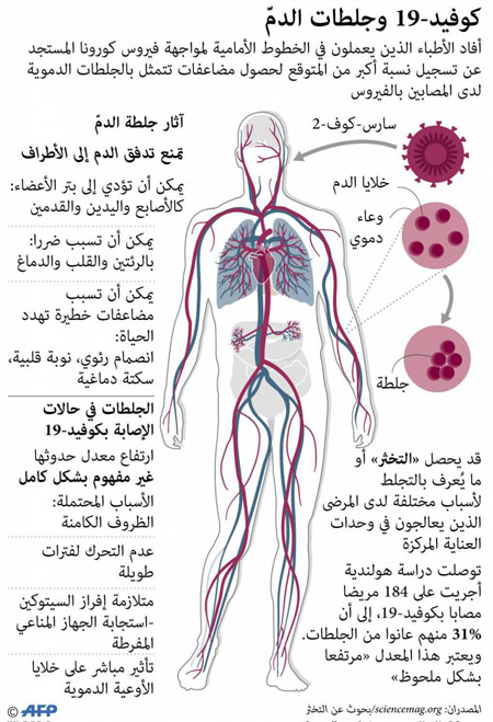 40 في المئة من حالات الوفاة ناتجة عن جلطات دموية