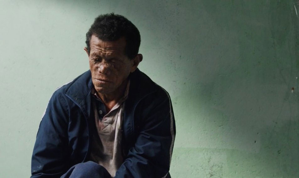 راضي جمال يتمنى أن يساهم الفيلم في توعية الجمهور بمرضى الجذام، حتى لا يخاف منهم الناس في الشارع أو ينبذونهم