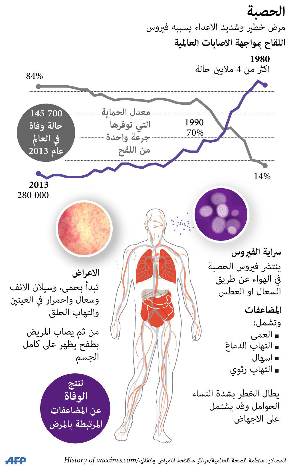 الحصبة Thumbnail